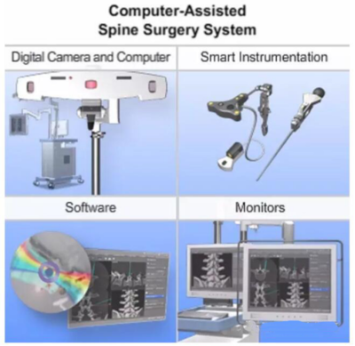 計(jì)算機(jī)輔助脊柱外科手術(shù)(Computer-assisted spine surgery)